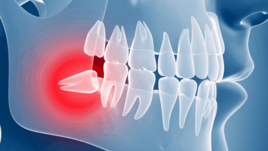 20’Lik Dişler Daha Hızlı Çürüyor 4
