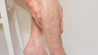 Kışa girerken varislerinizden kurtulun 3