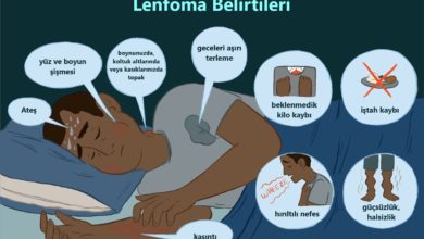 Non-Hodgkin Lenfoma 18