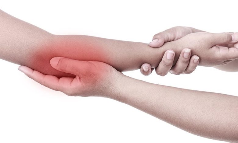 Lateral Epikondilit (Tenisçi Dirseği) Nedir? 30