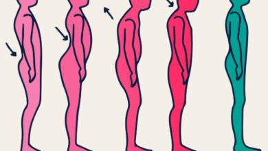 Duruş ve Duruş Bozuklukları 6