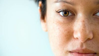 Lekelerden kurtulmanın yolları 19