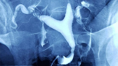 Rahim filmi (HSG) nedir? 2