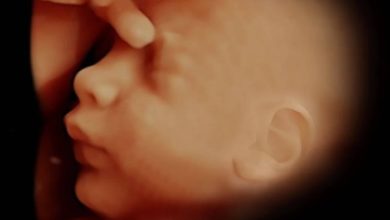 İleri (ayrıntılı) Fetal Ulturasonografi Nedir, Nasıl Yapılır? 9