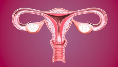 Basit (Atipisiz) Endometrial Hiperplazi Tedavisi (Rahim Duvarı Kalınlaşması Tedavisi) 11