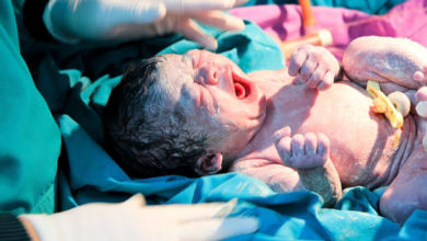 Sezeryan ile Doğum 7