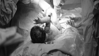 Sezeryan İle Doğum 13