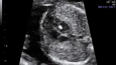 Kalpte Parlak (Beyaz) Nokta 1