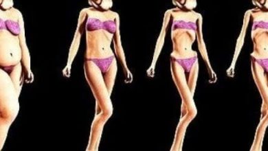 Anoreksiya Nervoza 14