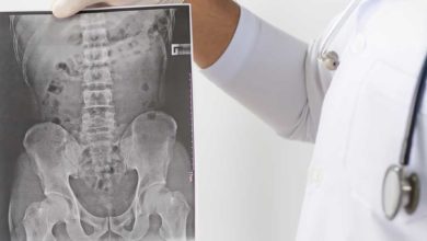 Tedavi Edilmeyen Bel Ağrısı Kamburluğa Yol Açabilir 8