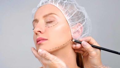 Mini Face Lifting (Mini Yüz Germe) 1