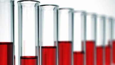 Kemiği İliği Nakli 1