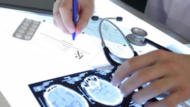 Göz tomografisi ile alzheımer ve parkınson hastalıklarının ön tanısı konabiliyor 3