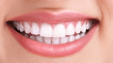 Estetik ve kozmetik diş hekimliği neden bu kadar önem kazandı ? 11