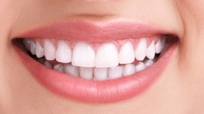 Estetik ve kozmetik diş hekimliği neden bu kadar önem kazandı ? 7