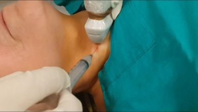 Tiroid nodülleri ve biyopsisi 11