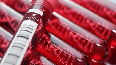 Çocuk hematolojisi nedir ve hangi hastalıklarla ilgilenir? 8