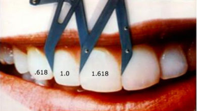 Gülüş tasarımı (altın oran) 11