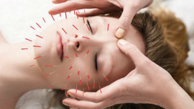 Akupunktur Nedir? 16