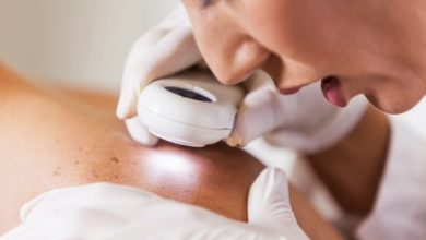 Tanısı Zor Konulan Dermatolojik Hastalıklara Dikkat! 6