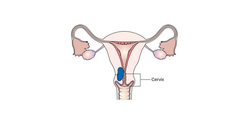 Tıkalı tüpler rahim filmi HSG ile açılır mı? 7