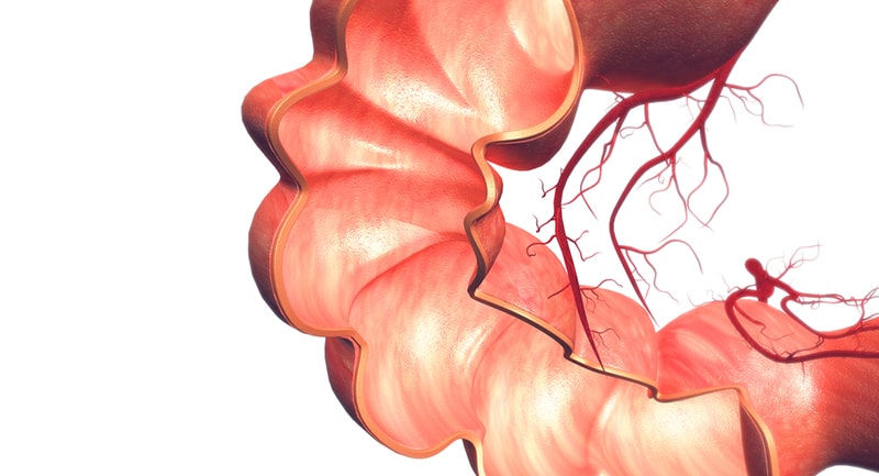 Kalın bağırsak kanseri nedir? 7