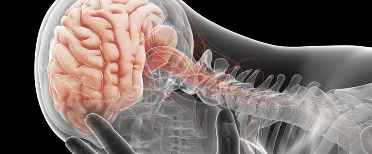 Geçici iskemik atak 7