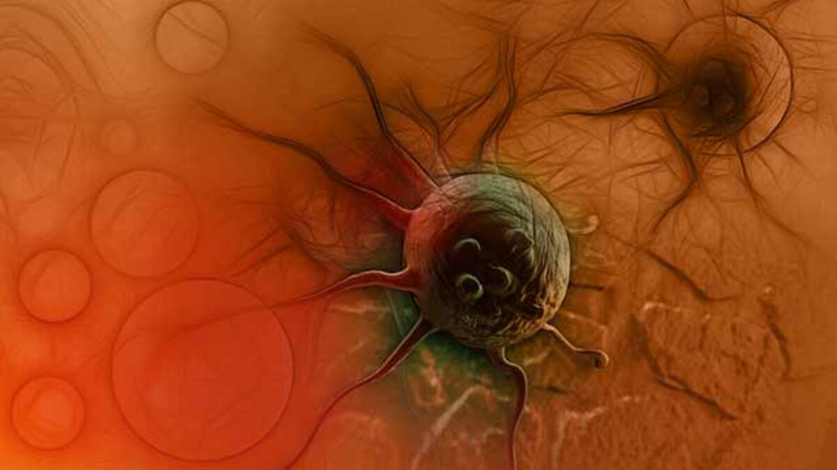 Mide hastalıkları ve mide kanseri 7