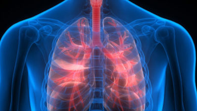 Akciğerin travmatik hastalıkları 3