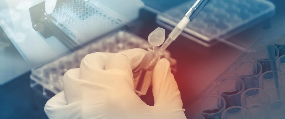 Genetik hastalık ( ailevi geçiş gösteren hastalık ) taraması nedir, kimlere yapılır? 7