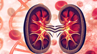 Böbrek nakli hakkında bilinmesi gerekenler 20