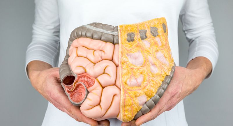 Kalın bağırsak (kolon ve rektum) kanseri önlenebilir bir hastalıktır 7