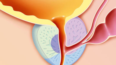 Prostat kanserinde tedavi seçenekleriniz 1