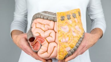 Kolon kanserinin nedenleri nelerdir? 3