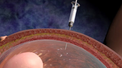 Genetik hastalıklar ve prenatal testler 1