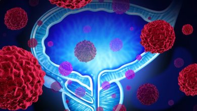 Prostat kanseri tedavisinde yenilikler 19