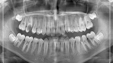 Oral diagnoz ve radyoloji 1
