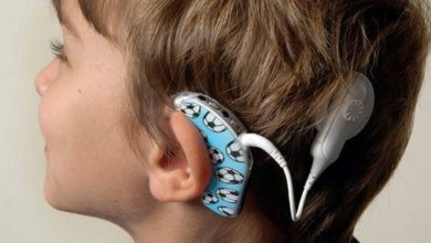 Koklear implant (biyonik kulak) 14