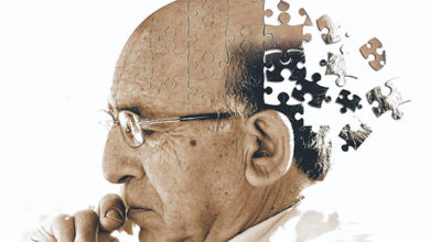 Alzehimer tedavisi 28