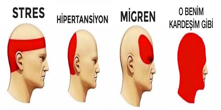 Baş ağrısı ve çeşitleri — haber görseli