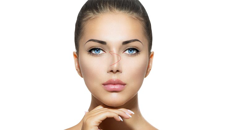 Burun kemik eğriliği 7