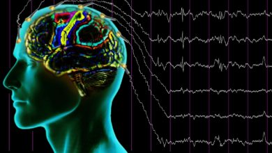 Epilepsi beynin oyunlarından biri 5