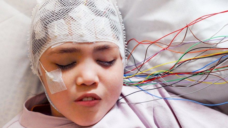 Epilepsi tedavisi nasıl yapılır? — haber görseli