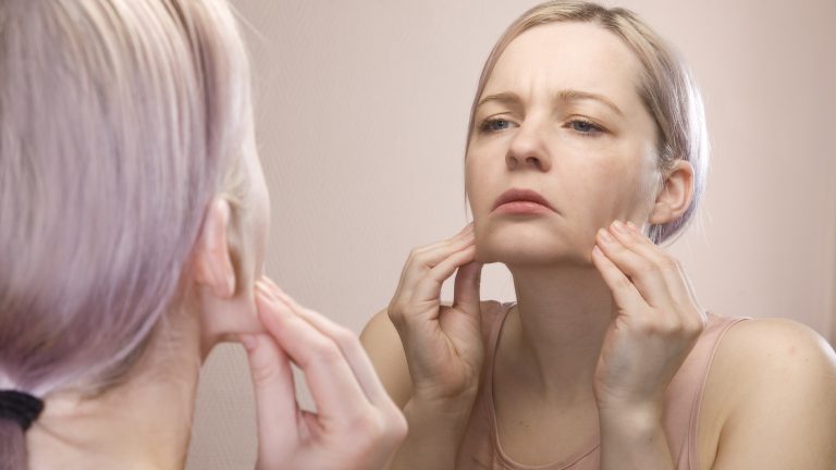 Hemifasiyal spazm nedir? Nasıl tedavi edilir? 7