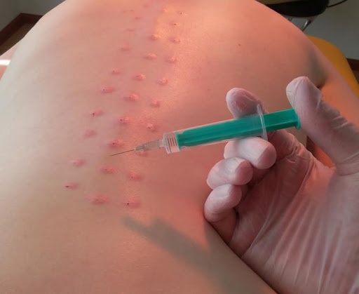 Nöralterapide tedavi protokolü 7