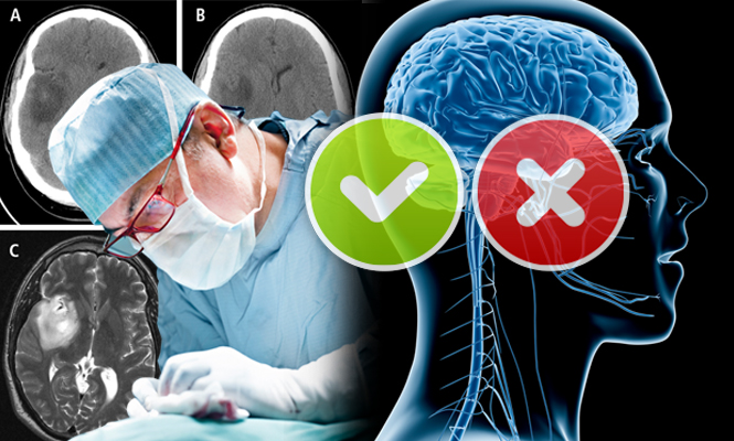 Psikiyatriste mi yoksa beyin cerrahisi uzmanına mı gitmeliyim? 7