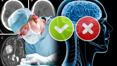 Psikiyatriste mi yoksa beyin cerrahisi uzmanına mı gitmeliyim? 9