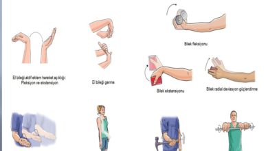 Lateral epikondilit ( tenisçi dirseği) ve fizyoterapi 1