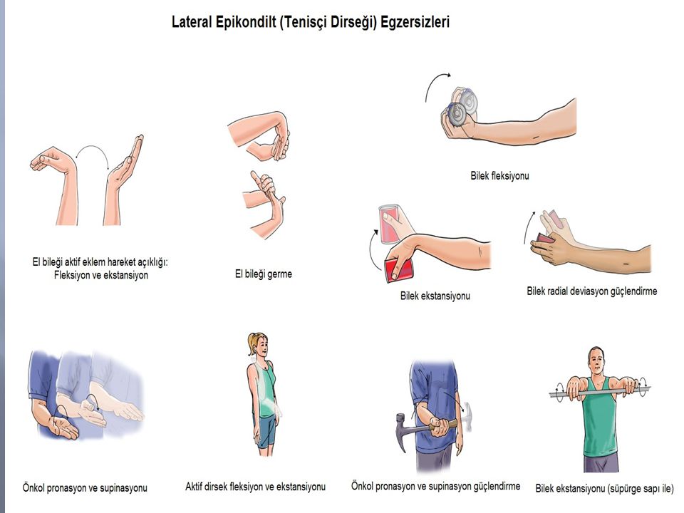 Lateral epikondilit ( tenisçi dirseği) ve fizyoterapi 7