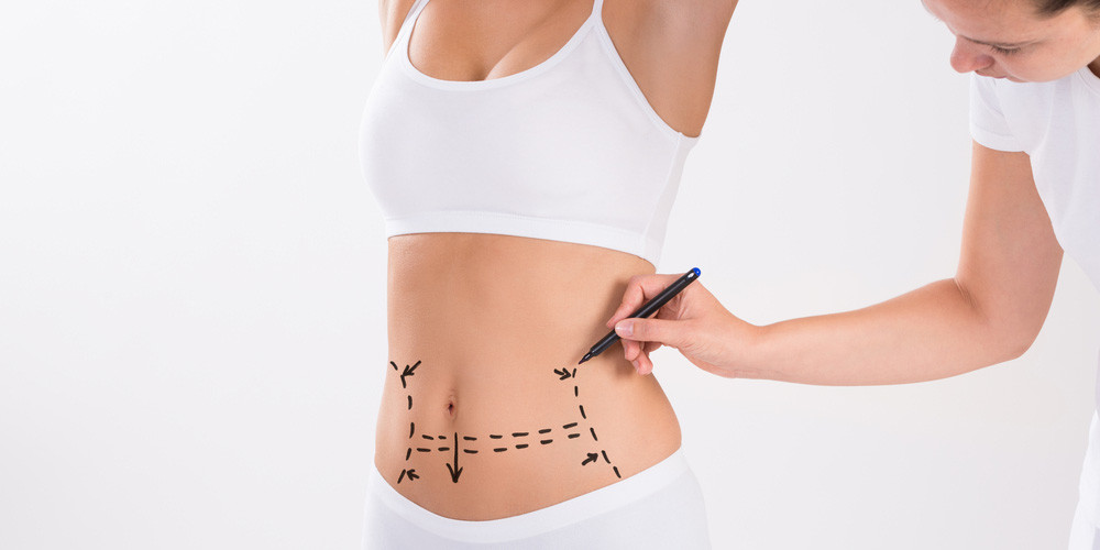 Mini karın germe herkese yapılır mı? 7